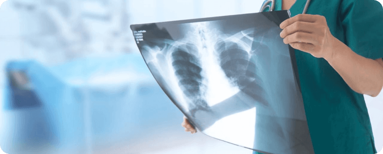 Radiologic technologist reviewing chest X-ray